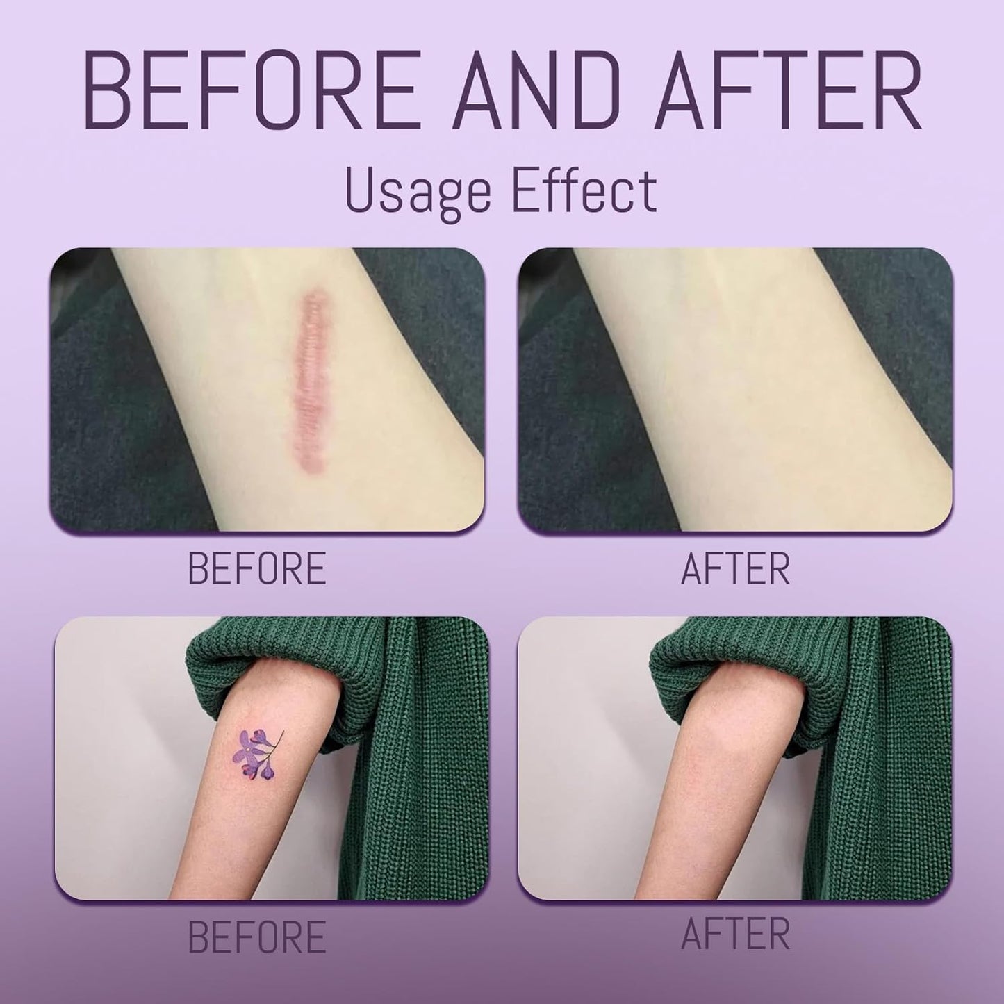 Body Coverage Perfector - Waterproof Body Makeup with Brush & Marshmallow Puff - No Transfer, Full Coverage for Tattoos, Scars, Veins (2.0oz Natural Beige)